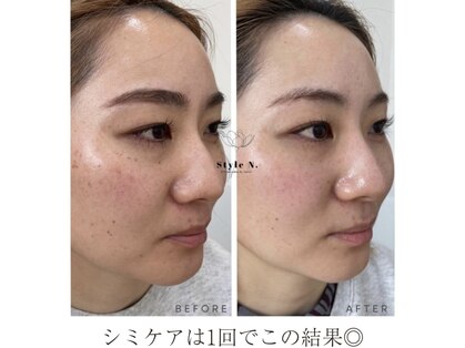 スタイルエヌ バイナース(Style N. by nurse)の写真
