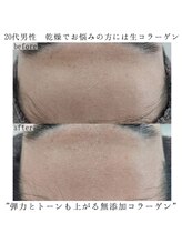 ヴェルシック(Belchic)/乾燥肌には生コラーゲン一択