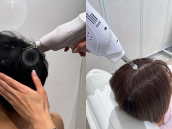 リジェネラティブセル メディカルサロン(Regenerative Cell Medical Salon)の写真/強い紫外線で弱った頭皮環境を３種混合幹細胞培養上清液（エクソソーム）がアプローチしてしっかりケア◎