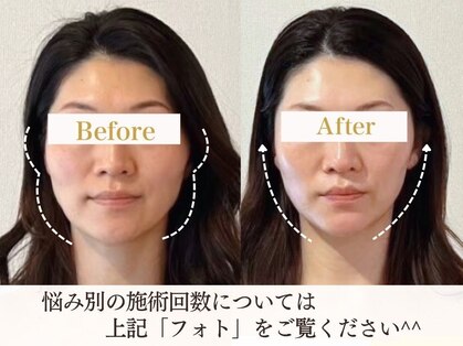 サロンキャン(Salon.CAN)の写真