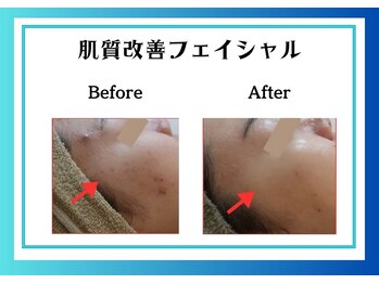 リヴェーヌ 富山店/お肌をしっかり見極め！