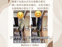 エヌキュア(N Cure)の雰囲気（80代の男性でもこのくらい姿勢を改善できます。）