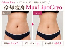 オリエンタルローザ 表参道(Oriental Rosa)の雰囲気(日本初!冷却痩身♪カッピング無しで吸引の違和感ゼロ!脂肪撃退)