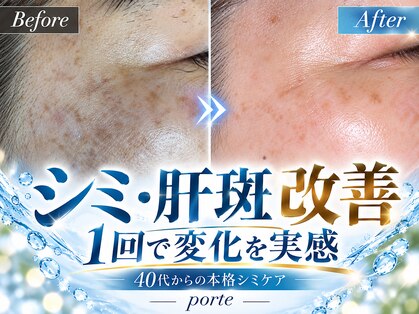 ポルテ(porte)の写真
