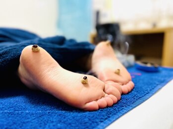 エマーマ(Emmama)/足裏にもお灸♪