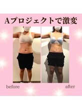 スタジオアクティブ(STUDIO Active)/【Aプロ】Before after