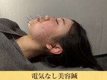 至福の空間 まごのて/【美容鍼】　電気なし