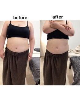 ジョワイユ(Joyeux)/腸の位置でお腹は変わる