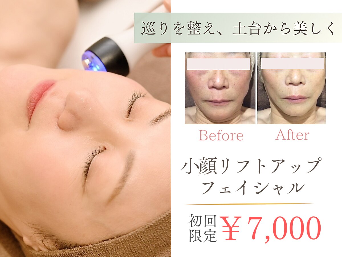 さいたま市浦和区で光フェイシャルが人気のエステサロン