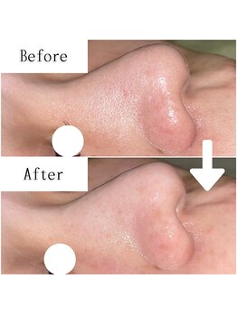 グラシア(gracia)/シミ・毛穴ケア専門店gracia