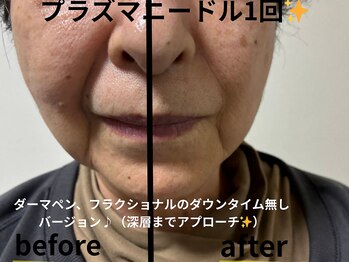 ルカクリニカル(Luka.CLINICAL)の写真/≪5月NEWオープン☆南国市≫元美容看護師の確かな知識でたるみを改善！エステサロン最上級の美肌体験を♪