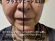 ルカクリニカル(Luka.CLINICAL)の写真/≪5月NEWオープン☆南国市≫元美容看護師の確かな知識でたるみを改善！エステサロン最上級の美肌体験を♪
