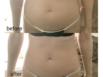 ブレスト 新宿本店(Breast)/《6回目》30代（痩身）