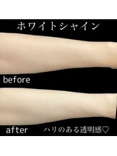 リブ(Lib)/夏の日焼けをリセット♪