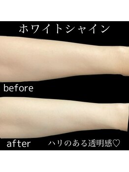 リブ(Lib)/夏の日焼けをリセット♪