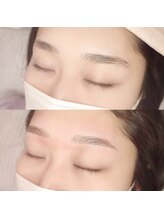 ブルーモ(Bloomo)/Before After［眉毛］