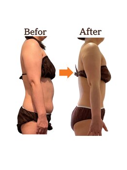 サルサナ(Salu Sana)/痩身！下腹ぽっこり解消！