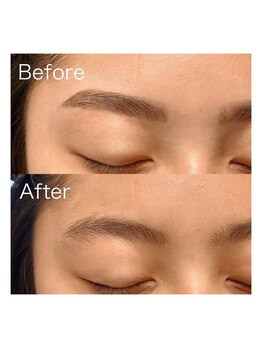 ビオラス(Biolus)/圧倒的な美しさ！