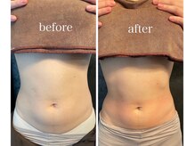 アンドボディ 横浜元町(&Body)/ウエストくびれ/痩身