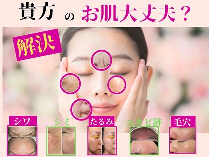 ルアナ(Luana.)の写真