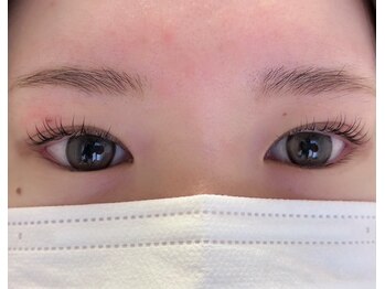 アドミーロ/左右差が気になる?