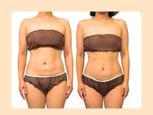 癒和(YUWA)/首肩のお悩みと同時に骨盤矯正に