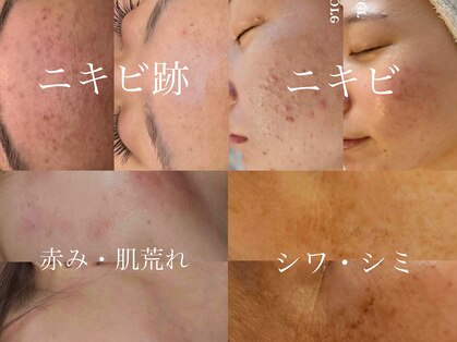 リリー(LILLY)の写真