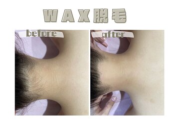 レヴィート(Revept)/【ワックス脱毛】