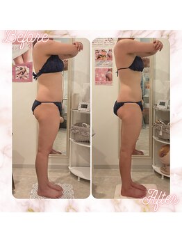 リムサロン(RIMSALON)/