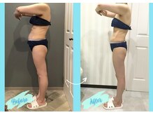 千歳の女神 三河安城店/【施術風景】Before/After