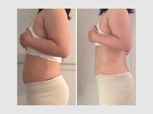 カロン 銀座(Kalon)/【腸もみ90分】1回結果！