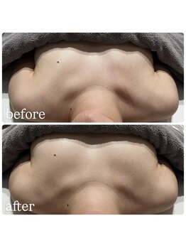 ブルーム(bluem)/上から見てもバストアップ！！