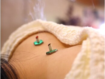 なみつき鍼灸整骨院の写真/【美容鍼灸¥3,980/骨盤調整¥2,500】低価格×高技術の高コスパ♪お手軽価格で気軽に立ち寄れる◎