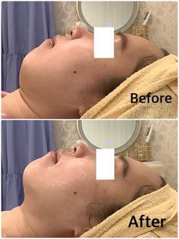 スペチアーレ 夙川/小顔と美肌で美顔革命