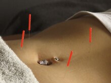 美容とダイエットの鍼灸院 Beene TOKYO 渋谷【3/1 NEW OPEN(予定)】