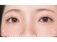 ライカ(Raika)の写真
