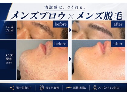 ノビシロホワイトニング(nobi-SHIROホワイトニング)の写真