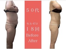 ムーン(MOON)/ 鏡を見るのが楽しみに。