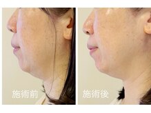 アリビオ(alivio)の雰囲気（食生活を変えず、手技だけでもこのように変化します。）