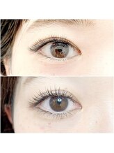 エイルミヤザキ(Ail Miyazaki)/カウンセリングに自信あり♪