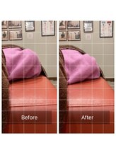 ナオル整体 宮崎院(NAORU整体)/20代女性施術事例【巻き肩】