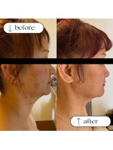 トータルビューティーサロンリア(Li'a)/ビフォー＆アフター