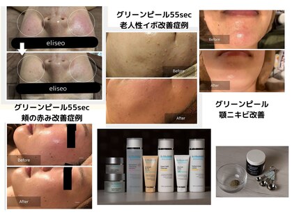 エリセオ(eliseo)の写真
