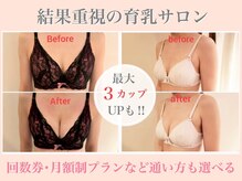 チュリップ(Tulipe)