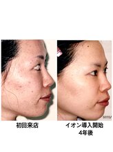 CATセンター 松茂/肌質改善の記録