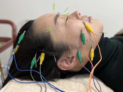 美容鍼灸salonまつもとの写真