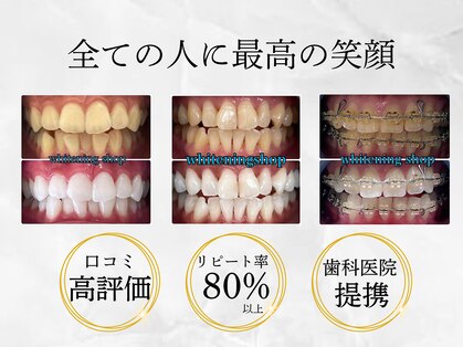 ホワイトニングショップ 鳳店の写真