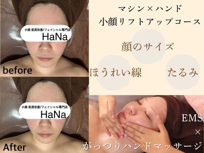 ハナ(HaNa)の写真
