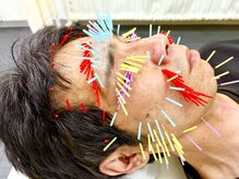 とだ鍼灸院の雰囲気（【腰仙骨★殿部★股関節周囲痛◎】内股歩き☆座り作業☆側弯！）