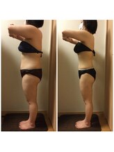 ロータス(Lotus)/30代　(左)ビフォー(右)アフター
